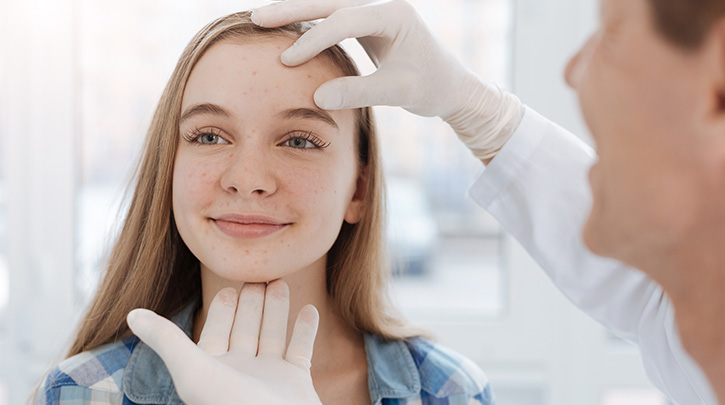 como ayudar a tu paciente con acne