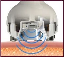 Pulsed Electro Magnetic Fields 