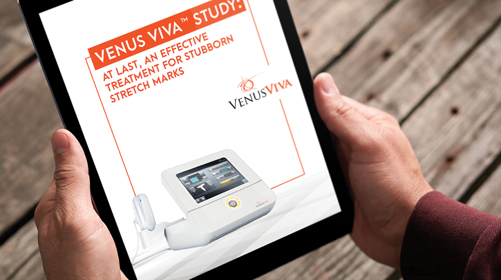 Increase Your Practice Revenue With Venus Viva™’s Striae Alba Treatment