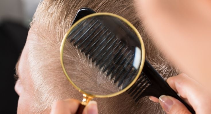 2020 Hair Restoration Industry Statistics To Consider
