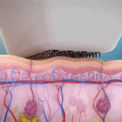 The Technology Behind the Venus Viva Tip Image 1