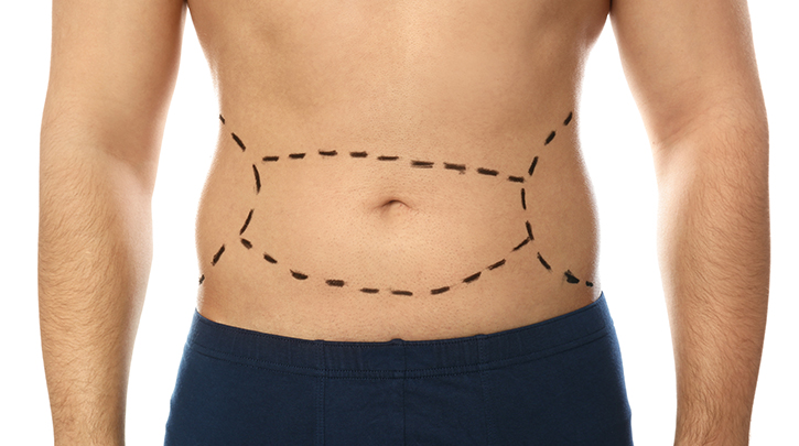 Popular Non-Surgical Fat Removal Procedures in Medical Aesthetic Practices Today