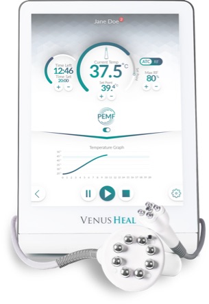 Venus Heal